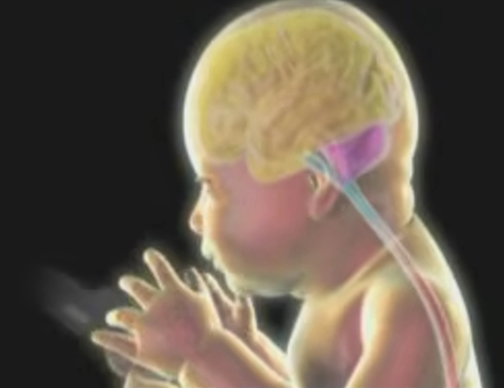 Illustration of neural plate folding into neural tube and four brain regions